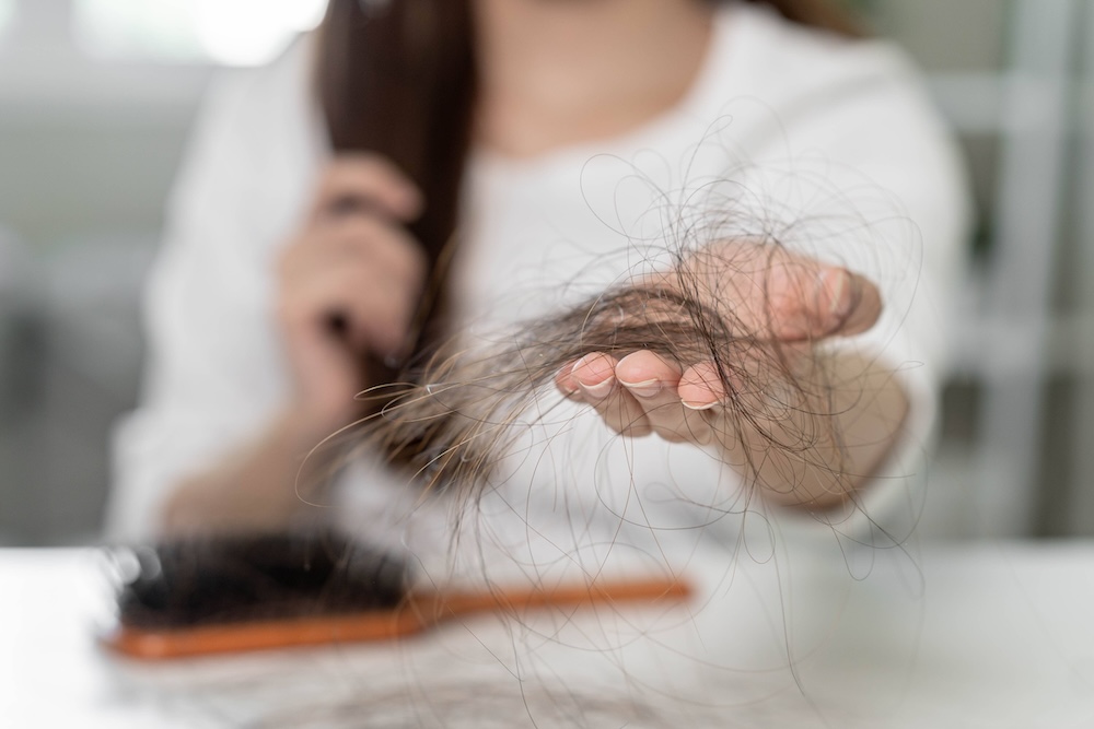 Chute de cheveux : les bienfaits de la mésothérapie