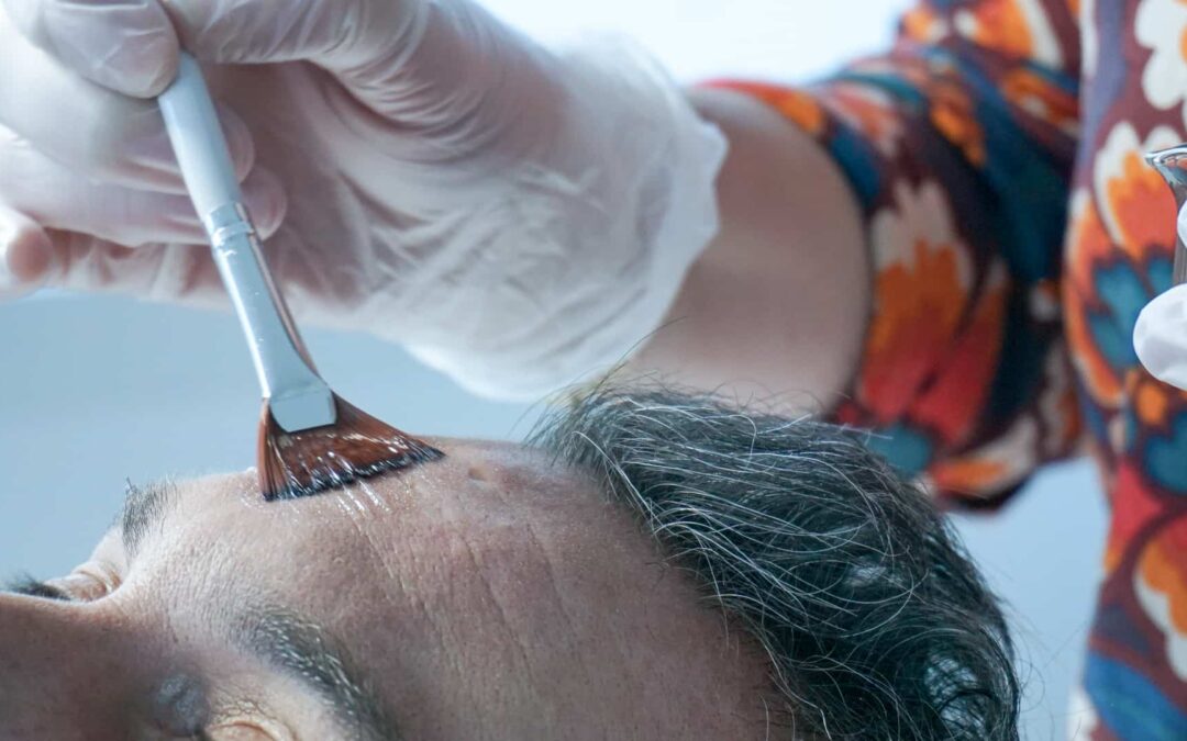 Peeling en médecine esthétique chez CLEM de Vannes