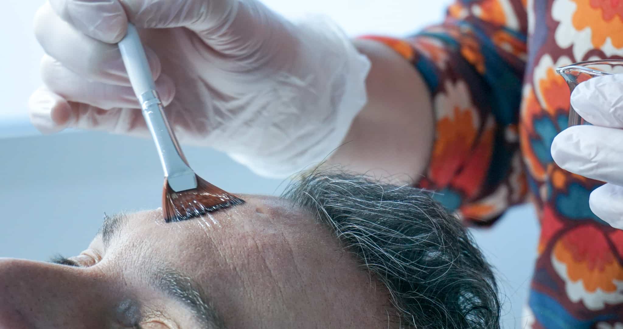 Peeling en médecine esthétique chez CLEM de Vannes