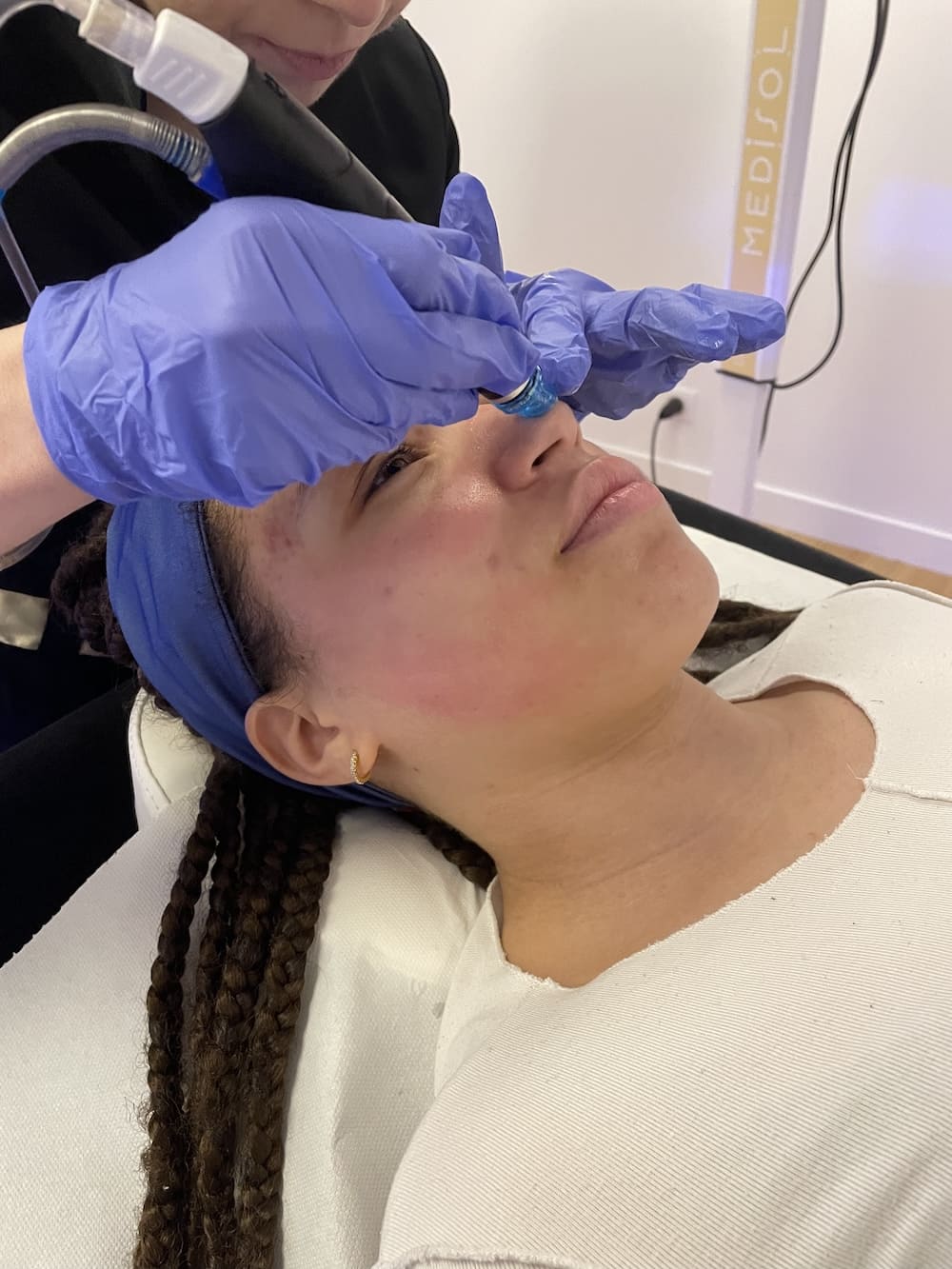 hydrafacial acné vannes