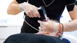 traitement par radiofréquences et microneedling chez CLEM Vannes