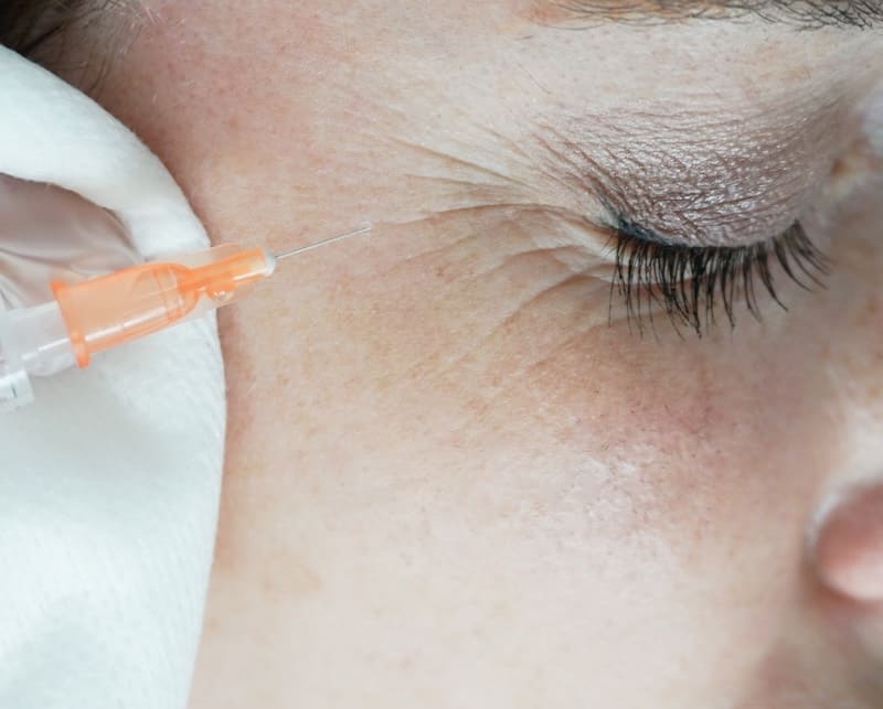 Injection d'acide hyaluronique chez CLEM à Vannes Morbihan