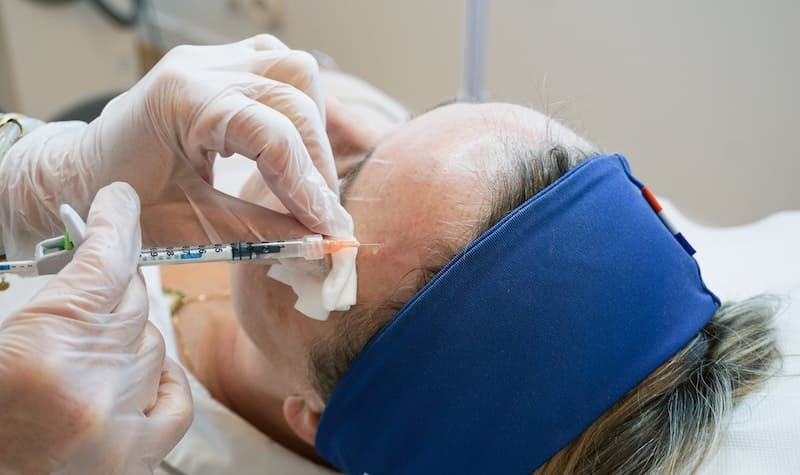 injections lèvres acide hyaluronique vannes morbihan