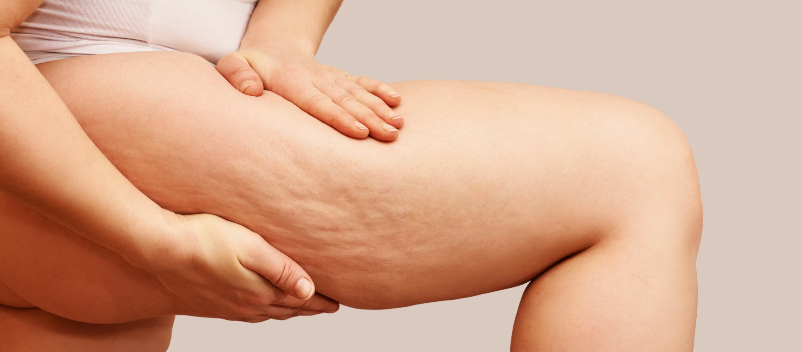 traitement de la cellulite chez Clem Vannes