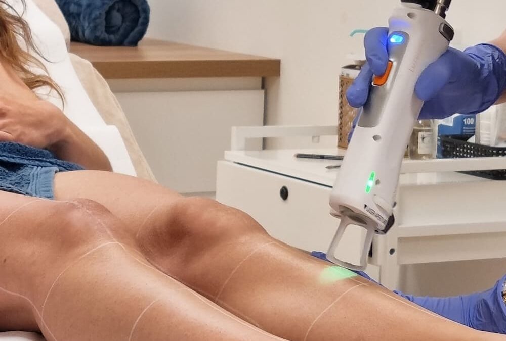 Épilation laser à Lorient : le guide complet pour une peau lisse durablement