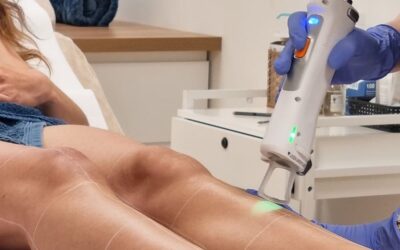 Épilation laser à Lorient : le guide complet pour une peau lisse durablement