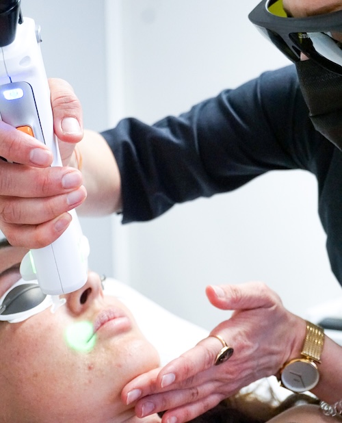 épilation laser Lorient (56)