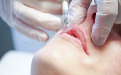Injections d’acide hyaluronique à Lorient : tout savoir avant de prendre rendez-vous chez CLEM Lorient